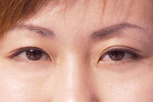 年齢肌におすすめな化粧水について